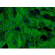 Human Hepatic Stellate Cells (HHSteC) - Immunostaining for α-SMA, 200x.
