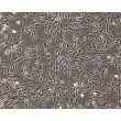 Human Hepatic Stellate Cells (HHSteC) - Phase contrast, 100x.
