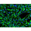 Human induced Pluripotent Stem Cell-derived Astrocytes - Immunostaining for Vimentin