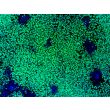 HiPSC-Derived Neural Crest Cells (HiPSC-NCC) - Immunostaining for SOX10, 100x