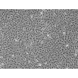 Human Iris Pigment Epithelial Cells (HIPEpiC) - Phase contrast, 100x.
