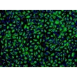 Human Iris Pigment Epithelial Cells (HIPEpiC) - Immunostaining for CK-18, 200x.
