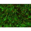 Human Leptomeningeal Pericytes (HLP) – Immunostaining for PDGF Receptor-Beta, 200x
