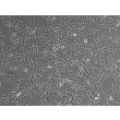 Human Leptomeningeal Pericytes (HLP) – Phase contrast, 100x
