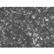 Human Leydig Cells (HLC) Phase contrast, 100x..
