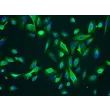 Human_Leydig Cells (HLC) Immunostaining for CK-18, 200x..
