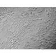Human Lymphatic Fibroblasts (HLF) - Relief contrast, 100x.
