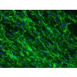 Human Lymphatic Fibroblasts (HLF) - Immunostaining for Fibronectin, 200x.
