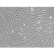 Human Meningeal Cells (HMC) - Phase contrast, 200x.

