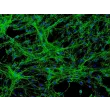 Human Meningeal Cells (HMC) - Immunostaining for Fibronectin, 200x.

