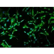 Human Mesenteric Fibroblasts (HMeF)-Immunostaining for Fibronectin, 200x
