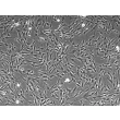 Human Mesenteric Fibroblasts (HMeF)-Phase Contrast, 100x
