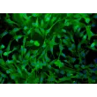 Human Myometrial Smooth Muscle Cells (HMSMC)-Immunostaining for α-sma, 200x.
