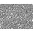 Human Nucleus Pulposus Cells (HNPC) - Phase contrast, 200x.
