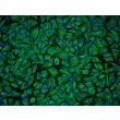 Human Nucleus Pulposus Cells (HNPC) - Immunostaining for Vimentin, 200x.
