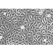 Human Oral Keratinocytes (HOK) - Phase contrast, 200x.
