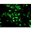 Human Oral Keratinocytes (HOK) - Immunostaining for CK-19, 400x.
