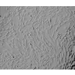 Human Ovarian Fibroblasts (HOF) - Relief contrast, 100x.
