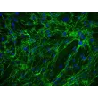 Human Ovarian Fibroblasts (HOF) - Immunostaining for Fibronectin, 200x.
