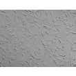 Human Pericardial Fibroblasts (HPcF) - Relief contrast, 100x.

