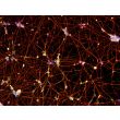 Human Pluripotent Stem Cell Derived-GABAergic Neurons  (HPSC-GABAN) -immunostained for Tubb3 (red) and GABA (green) 100X