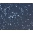 Human Pluripotent Stem Cell Derived-GABAergic Neurons  (HPSC-GABAN) - GABAergic Neurons, Phase contrast 100X