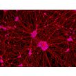 Human Pluripotent Stem Cell derived-Motor Neurons (HPSC-MN) - immunostained for Tubb3 (red) 100X