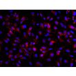 Human Pluripotent Stem Cell derived-Pericytes, immunostained for PDGFR-beta (red) 200X