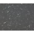 Human Pluripotent Stem Cell derived-Pericytes, Phase Contrast 100X