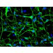 Human Pluripotent Stem Cell derived-Schwann Cells, immunostained for p75(green) 200X