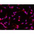Human Pluripotent Stem Cell derived-Schwann Cells, immunostained for GFAP (red) 200X