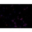 Human Pluripotent Stem Cell derived-Sensory Neurons (HPSC-SN) - immunostained for Brn3a (red) 100X