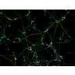 Human Pluripotent Stem Cell derived-Sensory Neurons (HPSC-SN) - immunostained for Brn3a (red) and Tubb3 (green) 100X