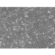 Human Pulmonary Artery Adventitia Fibroblasts (HPAAF) - Phase contrast, 100x.
