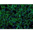 Human Pulmonary Artery Adventitia Fibroblasts (HPAAF) - Immunostaining for Fibronectin, 200x.

