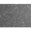 Human Pulmonary Artery Smooth Muscle Cells (HPASMC) - Phase contrast, 100x.
