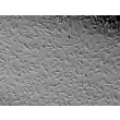 Human Pulmonary Artery Smooth Muscle Cells (HPASMC) - Relief contrast, 100x.
