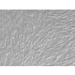 Human Pulmonary Fibroblasts (HPF) - Relief contrast, 400x.
