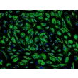Human Pulmonary Microvascular Endothelial Cells (HPMEC) - Immunostaining for vWF, 200x.
