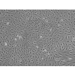 Human Renal Glomerular Endothelial Cells (HRGEC) - Phase contrast, 100x.
