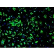 Human Renal Glomerular Endothelial Cells (HRGEC) - Immunostaining for vWF, 200x.
