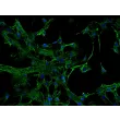 Human Renal Mesangial Cells (HRMC) - Immunostaining for Fibronectin, 200x.