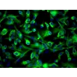 Human Renal Proximal Tubular Epithelial Cells (HRPTEpiC) - Immunostaining for CK-18, 200x.
