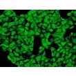 Human Seminal Vesicle Epithelial Cells (HSVEpiC) - Immunostaining for CK-18, 100x.
