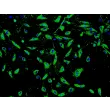 Human Seminal Vesicle Microvascular Endothelial Cells (HSVMEC) - Immunostaining for vWF, 100x.
