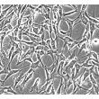 Human Skeletal Muscle Satellite Cells (HSkMSC) - Phase contrast, 200x.
