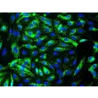 Human Splenic Endothelial Cells (HSEC) - Immunostaining for vWF, 400x.
