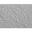 Human Synoviocytes (HS) - Relief contrast, 400x.
