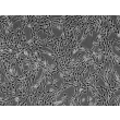 Human Thymic Fibroblasts (HTyF) - Phase contrast, 100x.
