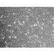 Human Thyroid Fibroblasts (HThF) - Phase contrast, 100x.
